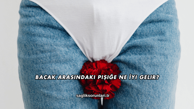 Bacak Arasındaki Pişiğe Ne İyi Gelir?