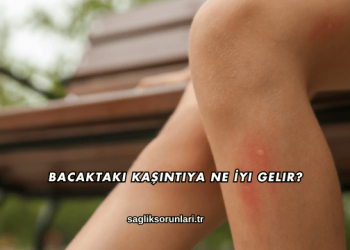 Bacaktaki Kaşıntıya Ne İyi Gelir?