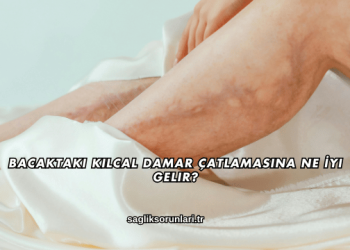 Bacaktaki Kılcal Damar Çatlamasına Ne İyi Gelir?