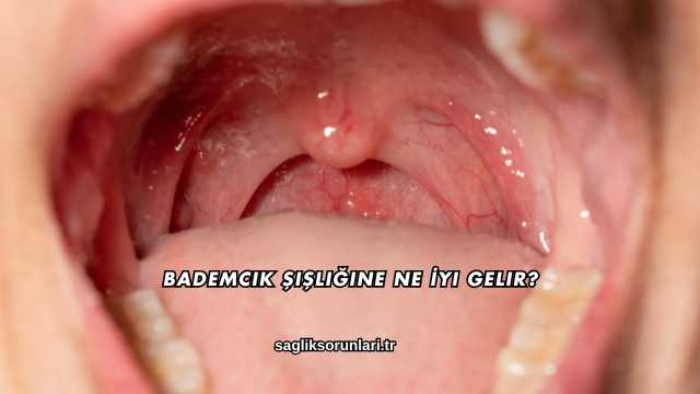 Bademcik Şişliğine Ne İyi Gelir?