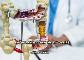 Bağırsak Gazına Ne İyi Gelir?