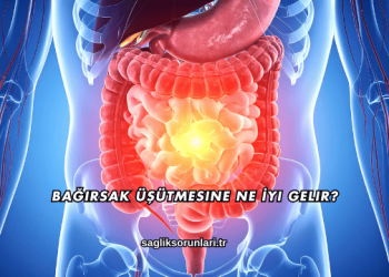 Bağırsak Üşütmesine Ne İyi Gelir?