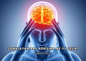 Zonklayan Baş Ağrısına Ne İyi Gelir?