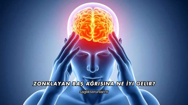 Zonklayan Baş Ağrısına Ne İyi Gelir?