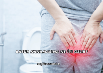 Basur Kanamasına Ne İyi Gelir?