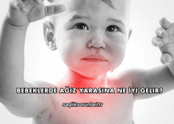 Bebeklerde Ağız Yarasına Ne İyi Gelir?