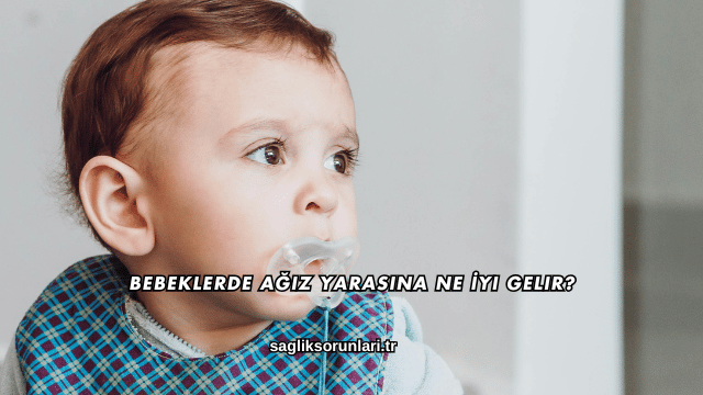 Bebeklerde Ağız Yarasına Ne İyi Gelir?