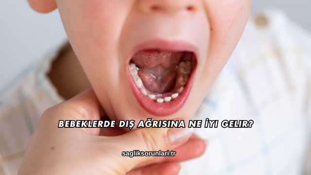 Bebeklerde Diş Ağrısına Ne İyi Gelir?