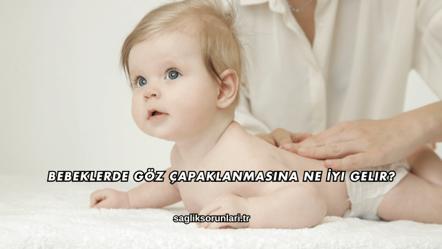 Bebeklerde Göz Çapaklanmasına Ne İyi Gelir?