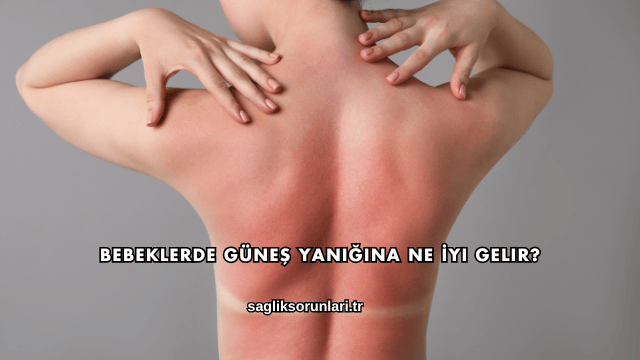 Bebeklerde Güneş Yanığına Ne İyi Gelir?