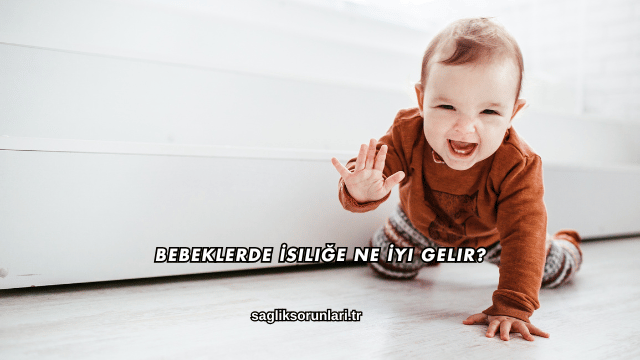 Bebeklerde İsiliğe Ne İyi Gelir?