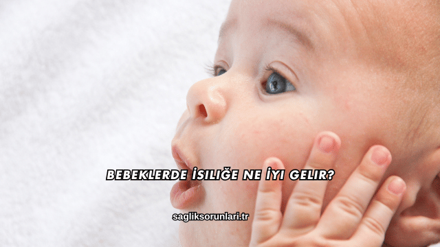 Bebeklerde İsiliğe Ne İyi Gelir?