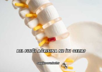 Bel Fıtığı Ağrısına Ne İyi Gelir?
