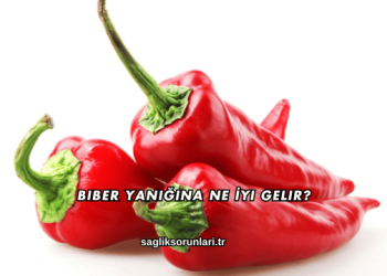 Biber Yanığına Ne İyi Gelir?