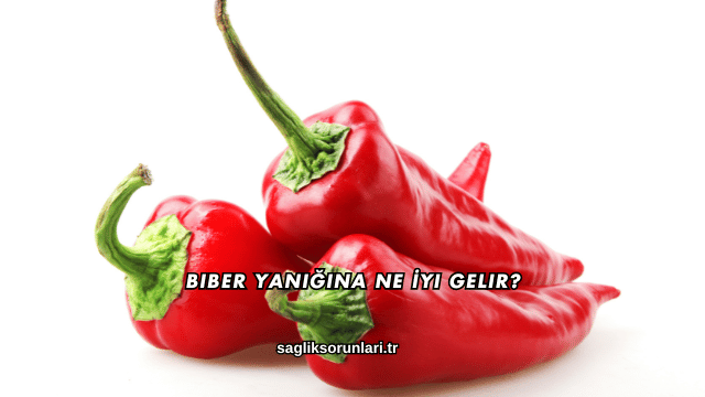 Biber Yanığına Ne İyi Gelir?