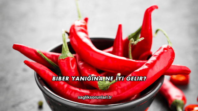 Biber Yanığına Ne İyi Gelir?