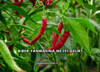 Biber Yanmasına Ne İyi Gelir?