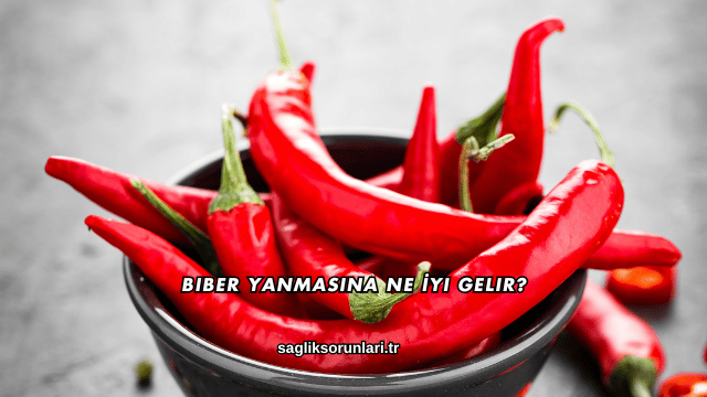 Biber Yanmasına Ne İyi Gelir?