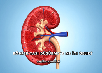 Böbrek Taşı Düşürmeye Ne İyi Gelir?