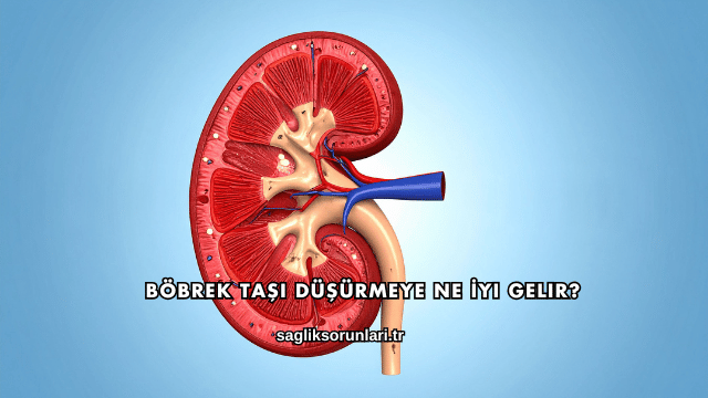 Böbrek Taşı Düşürmeye Ne İyi Gelir?