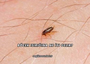 Böcek Isırığına Ne İyi Gelir?