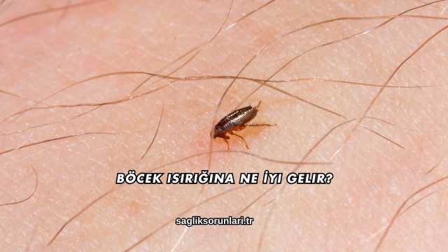 Böcek Isırığına Ne İyi Gelir?