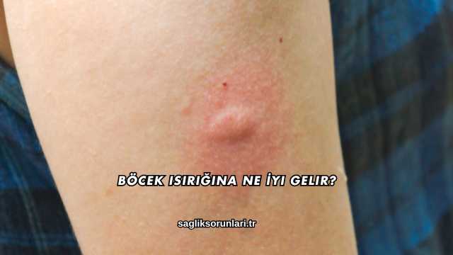 Böcek Isırığına Ne İyi Gelir?