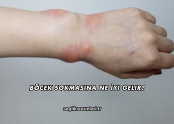 Böcek Sokmasına Ne İyi Gelir?