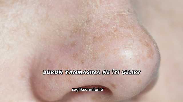 Burun Yanmasına Ne İyi Gelir?