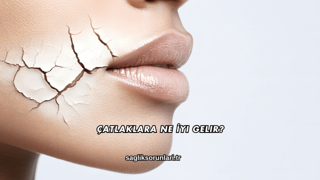 Çatlaklara Ne İyi Gelir?