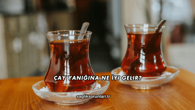 Çay Yanığına Ne İyi Gelir?