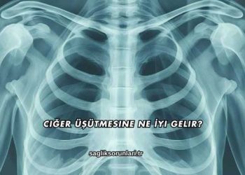 Ciğer Üşütmesine Ne İyi Gelir?