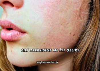 Cilt Alerjisine Ne İyi Gelir?