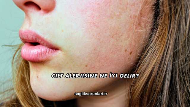 Cilt Alerjisine Ne İyi Gelir?