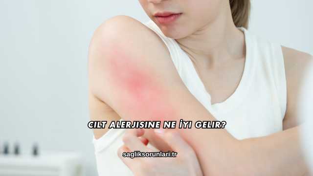Cilt Alerjisine Ne İyi Gelir?