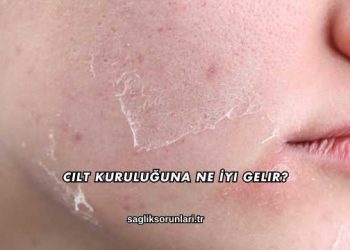 Cilt Kuruluğuna Ne İyi Gelir?