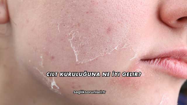 Cilt Kuruluğuna Ne İyi Gelir?