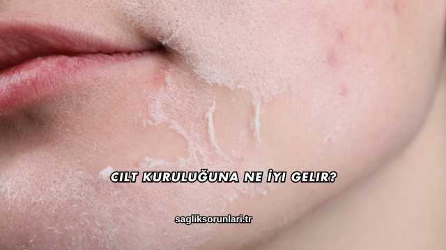 Cilt Kuruluğuna Ne İyi Gelir?