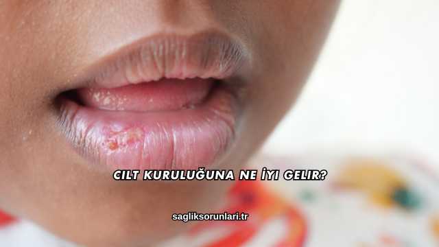 Cilt Kuruluğuna Ne İyi Gelir?