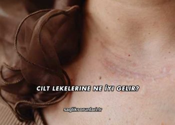 Cilt Lekelerine Ne İyi Gelir?