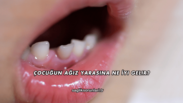 Çocuğun Ağız Yarasına Ne İyi Gelir?