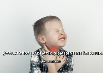 Çocuklarda Bademcik Şişmesine Ne İyi Gelir?