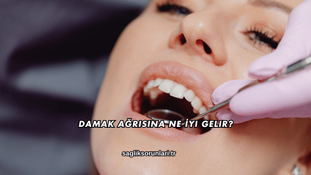 Damak Ağrısına Ne İyi Gelir?