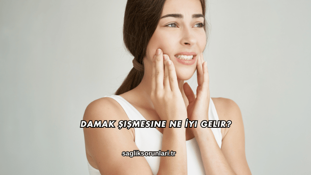 Damak Şişmesine Ne İyi Gelir?