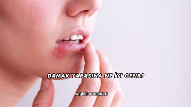 Damak Yarasına Ne İyi Gelir?