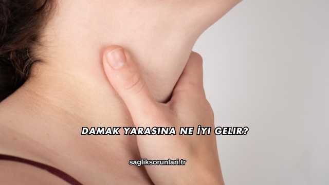 Damak Yarasına Ne İyi Gelir?