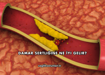 Damar Sertliğine Ne İyi Gelir?