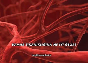 Damar Tıkanıklığına Ne İyi Gelir?