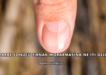 Darbe Sonucu Tırnak Morarmasına Ne İyi Gelir?