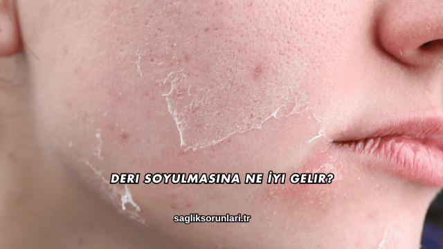 Deri Soyulmasına Ne İyi Gelir?